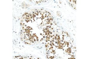 IHC analysis of DDX4 using anti-DDX4 antibody (ABIN7601203).