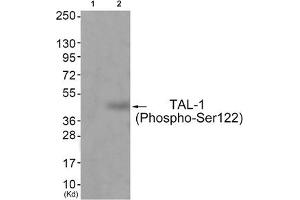 Western blot analysis of extracts from JK cells (Lane 2), using TAL-1 (Phospho-Ser122) Antibody. (TAL1 Antikörper  (pSer122))