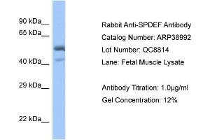 WB Suggested Anti-SPDEF Antibody   Titration: 1.