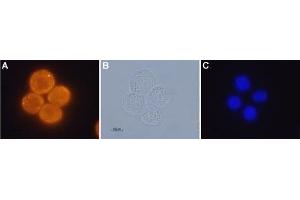 Expression of OX1R in human colon cancer cell lines - Immunocytochemical staining of paraformaldehyde fixed and permeabilized human Colo-205 colon cancer cells A. (HCRTR1 Antikörper  (AA 256-269))