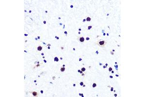 Immunohistochemistry of paraffin-embedded mouse spinal cord using DDX5 Rabbit mAb (ABIN7266698) at dilution of 1:100 (40x lens). (DDX5 Antikörper)
