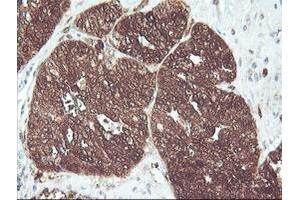 Image no. 7 for anti-CNDP Dipeptidase 2 (Metallopeptidase M20 Family) (CNDP2) antibody (ABIN1497548) (CNDP2 Antikörper)