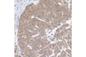 Immunohistochemistry (IHC) image for anti-Ribosomal Protein L5 (RPL5) (AA 247-297) antibody (ABIN7454984) (RPL5 Antikörper  (AA 247-297))
