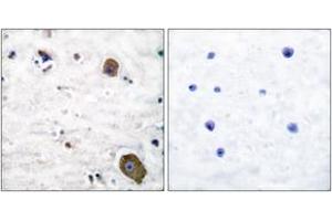 Immunohistochemistry analysis of paraffin-embedded human brain tissue, using GFR alpha-1 Antibody. (GFRA1 Antikörper  (AA 51-100))