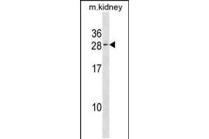 Western blot analysis in kidney cell line lysates (35ug/lane). (VPS25 Antikörper  (C-Term))