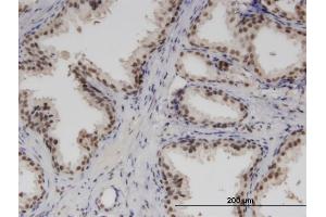 Immunoperoxidase of monoclonal antibody to RBM6 on formalin-fixed paraffin-embedded human prostate. (RBM6 Antikörper  (AA 1024-1123))