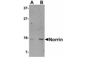 Image no. 1 for anti-Norrie Disease (Pseudoglioma) (NDP) (N-Term) antibody (ABIN478068)