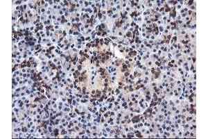 Image no. 1 for anti-F-Box Protein 21 (FBXO21) antibody (ABIN1498231) (FBXO21 Antikörper)