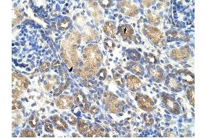 GNB1L antibody was used for immunohistochemistry at a concentration of 4-8 ug/ml to stain Epithelial cells of renal tubule (arrows) in Human Kidney. (GNB1L Antikörper)