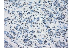 Immunohistochemical staining of paraffin-embedded breast tissue using anti-PPP5C mouse monoclonal antibody. (PP5 Antikörper)