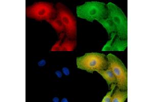 ABIN7096261 and ABIN7100323 staining  cells by IF/ICC. (SLC25A43 Antikörper)
