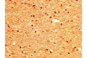 IHC image of ABIN7168378 diluted at 1:500 and staining in paraffin-embedded human brain tissue performed on a Leica BondTM system. (MSI1 Antikörper  (AA 221-347))