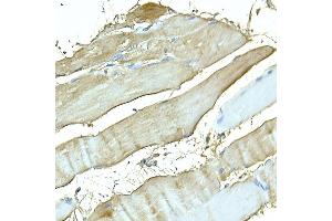 Immunohistochemistry (IHC) image for anti-Myosin Heavy Chain 4, Skeletal Muscle (MYH4) (AA 1450-1550) antibody (ABIN7268749)