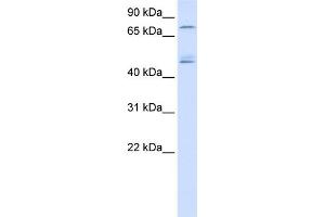 WB Suggested Anti-DDX1 Antibody Titration:  0. (DDX1 Antikörper  (N-Term))