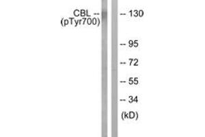 Western blot analysis of extracts from K562 cells treated with Na3VO4 0. (CBL Antikörper  (pTyr700))