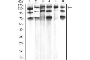 Western Blotting (WB) image for anti-phospholipase C, gamma 1 (PLCG1) (AA 1192-1291) antibody (ABIN5542680)