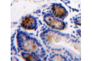 Immunohistochemistry (IHC) image for anti-Angiogenic Factor with G Patch and FHA Domains 1 (AGGF1) (AA 406-501) antibody (ABIN1866581)