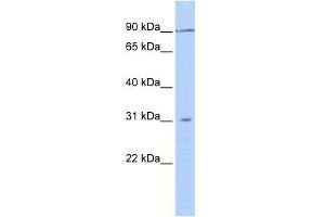 TMEM146 antibody used at 1 ug/ml to detect target protein.