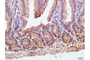 Immunohistochemistry (Paraffin-embedded Sections) (IHC (p)) image for anti-Solute Carrier Family 30 (Zinc Transporter), Member 1 (SLC30A1) (AA 131-330) antibody (ABIN1386095)