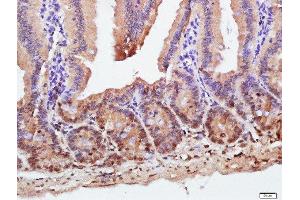 Paraformaldehyde-fixed, paraffin embedded mouse intestine tissue, Antigen retrieval by boiling in sodium citrate buffer(pH6) for 15min, Block endogenous peroxidase by 3% hydrogen peroxide for 30 minutes, Blocking buffer (normal goat serum) at 37°C for 20min, Antibody incubation with ZnT-1 Polyclonal Antibody, Unconjugated  at 1:500 overnight at 4°C, followed by a conjugated secondary and DAB staining (SLC30A1 Antikörper  (AA 131-330))