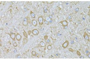Immunohistochemistry of paraffin-embedded Mouse brain using MTNR1A Polyclonal Antibody at dilution of 1:100 (40x lens). (Melatonin Receptor 1A Antikörper)