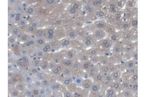 DAB staining on IHC-P; Samples: Mouse Liver Tissue (AGXT Antikörper  (AA 120-334))