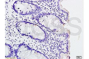 Immunohistochemistry (IHC) image for anti-Interleukin 1 Receptor, Type I (IL1R1) (pTyr496) antibody (ABIN801423)