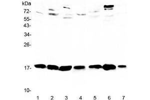 Western blot testing of 1) rat testis, 2) rat brain, 3) rat thymus, 4) mouse testis, 5) mouse brain, 6) mouse thymus and 7) mouse HEPA1-6 lysate with WFDC2 antibody at 0.