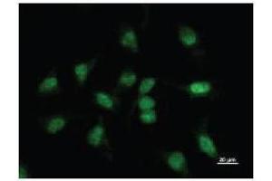 Immunostaining analysis in HeLa cells. (BBX Antikörper)