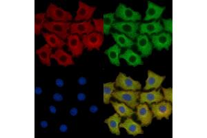 Annexin A2 Mouse Monoclonal Antibody staining HepG2 cells by IF/ICC.