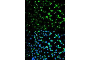 Immunofluorescence analysis of HeLa cell using TYMP antibody. (Thymidine Phosphorylase Antikörper)