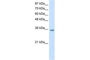 Western Blotting (WB) image for anti-Homeobox D4 (HOXD4) antibody (ABIN2461853) (HOXD4 Antikörper)