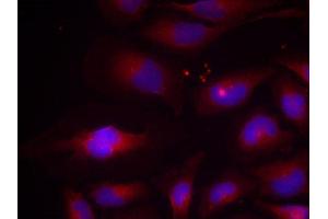 Immunofluorescence (IF) image for anti-Nuclear Factor of kappa Light Polypeptide Gene Enhancer in B-Cells 2 (NFKB2) (pSer870) antibody (ABIN1870475) (NFKB2 Antikörper  (pSer870))