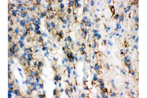 Anti-GAP43 antibody, IHC(P) IHC(P): Human Glioma Tissue (GAP43 Antikörper  (C-Term))
