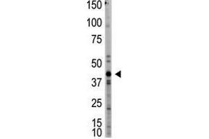 Image no. 1 for anti-Myostatin (MSTN) (N-Term) antibody (ABIN357462) (MSTN Antikörper  (N-Term))