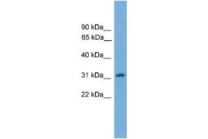 WB Suggested Anti-PIGL  Antibody Titration: 0. (PIGL Antikörper  (N-Term))