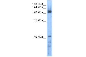 RecQL5 antibody used at 0. (RECQL5 Antikörper  (Middle Region))