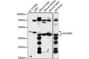 Western blot analysis of extracts of various cell lines, using KCN antibody (ABIN7269480) at 1:1000 dilution. (KCNAB1 Antikörper  (AA 282-401))