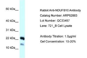 Western Blotting (WB) image for anti-NADH Dehydrogenase (Ubiquinone) 1 beta Subcomplex, 10, 22kDa (NDUFB10) (C-Term) antibody (ABIN2789283) (NDUFB10 Antikörper  (C-Term))