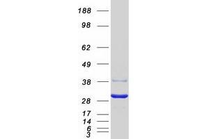 Western Blotting (WB) image for Eukaryotic Translation Initiation Factor 4E Family Member 2 (EIF4E2) protein (Myc-DYKDDDDK Tag) (ABIN2720100)