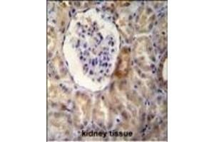 NR3C1 Antibody (C-term) B immunohistochemistry analysis in formalin fixed and paraffin embedded human kidney tissue followed by peroxidase conjugation of the secondary antibody and DAB staining. (Glucocorticoid Receptor Antikörper  (C-Term))