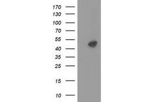 Western Blotting (WB) image for anti-Protein Kinase, CAMP-Dependent, Regulatory, Type II, alpha (PRKAR2A) antibody (ABIN1500254) (PRKAR2A Antikörper)