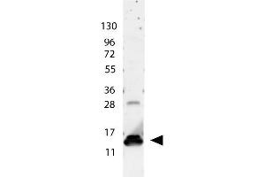 anti-Human IL-9 antibody shows detection of a band ~15 kDa in size corresponding to recombinant human IL-9. (IL-9 Antikörper)