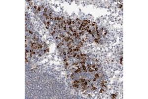 Immunohistochemical staining of human lymph node with TMEM69 polyclonal antibody  shows strong cytoplasmic positivity in lymphoid cells outside reaction centra at 1:20-1:50 dilution. (TMEM69 Antikörper)