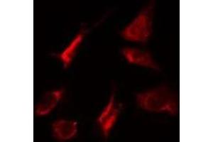 ABIN6275267 staining HeLa cells by IF/ICC. (MYO5A Antikörper  (C-Term))