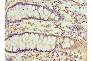 Immunohistochemistry of paraffin-embedded human colon tissue using ABIN7151115 at dilution of 1:100