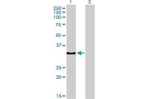 Western Blot analysis of SSR1 expression in transfected 293T cell line by SSR1 monoclonal antibody (M02), clone 1C11. (SSR1 Antikörper  (AA 33-286))