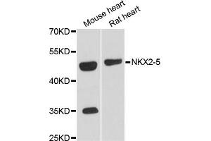 Western blot analysis of extracts of various cell lines, using NKX2-5 antibody (ABIN6293408) at 1:3000 dilution. (NK2 Homeobox 5 Antikörper)