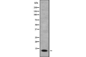 Western blot analysis FDCSP using HepG2 whole cell lysates (FDCSP Antikörper  (Internal Region))