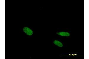 Immunofluorescence of purified MaxPab antibody to VDR on HeLa cell.